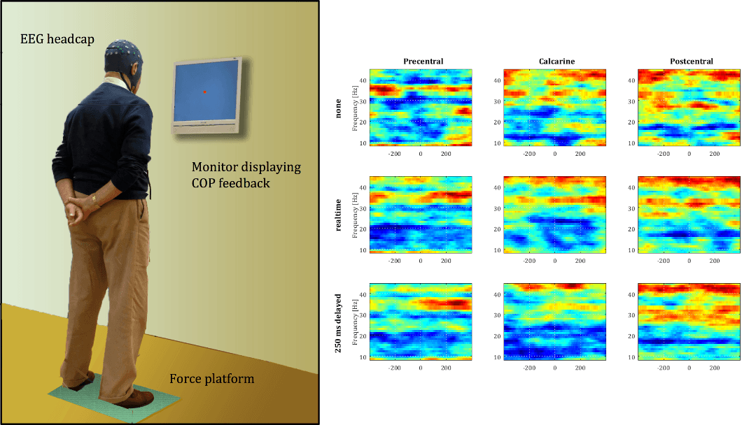 Cueing in Parkinson’s disease