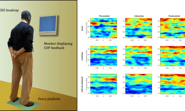 Cueing in Parkinson’s disease