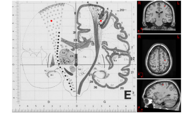 Neural Underpinnings