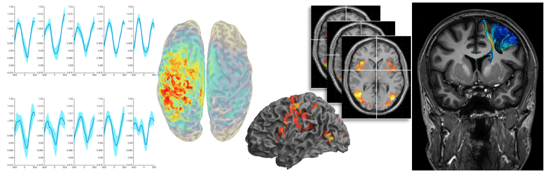 Effects of ageing on inter-hemispheric cross-talk – Studying EEG, FMRI, and DTI in the context of motor learning