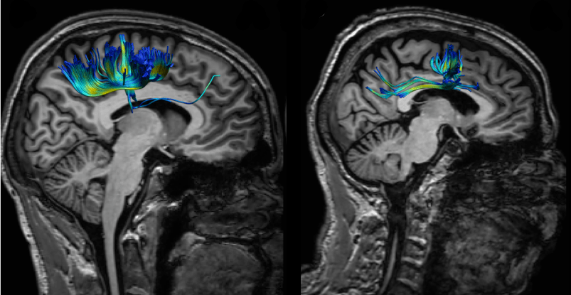 Age effects in bimanual coordination