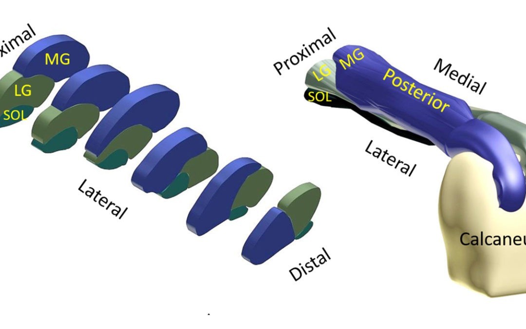 Force transmission within the Achilles tendon