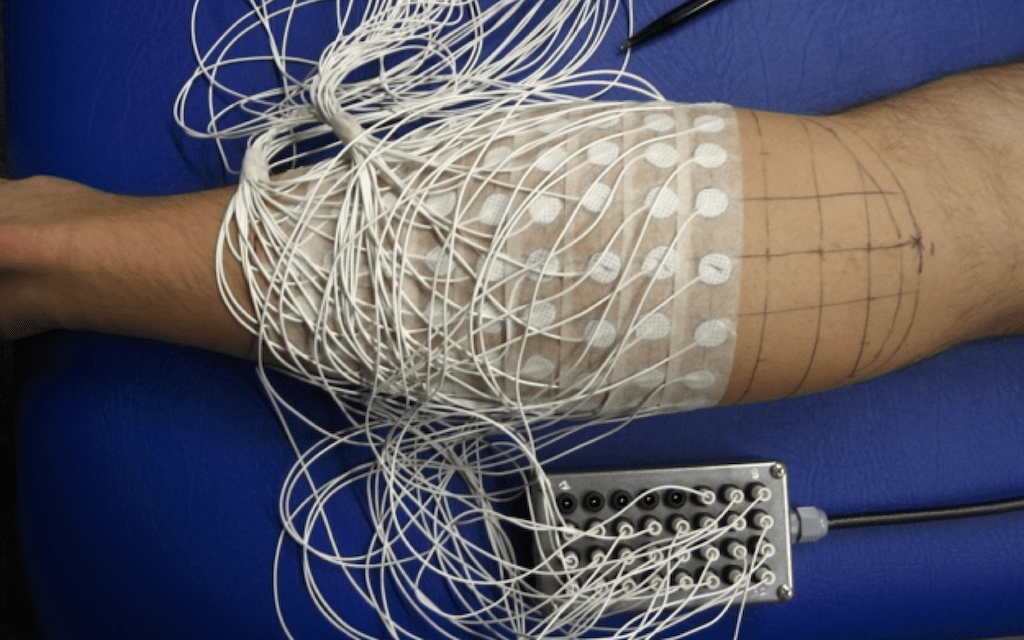 Unravelling the etiology of muscle injuries