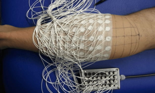 Unravelling the etiology of muscle injuries