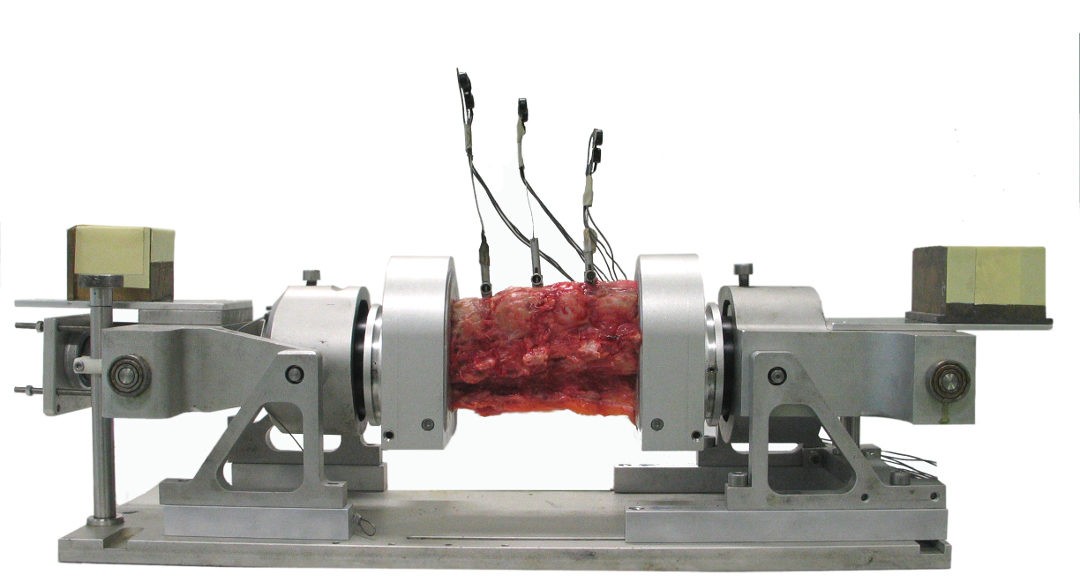 Spine Biomechanics