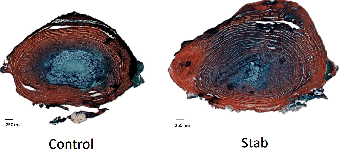 Interactions between disc degeneration and multifidus atrophy
