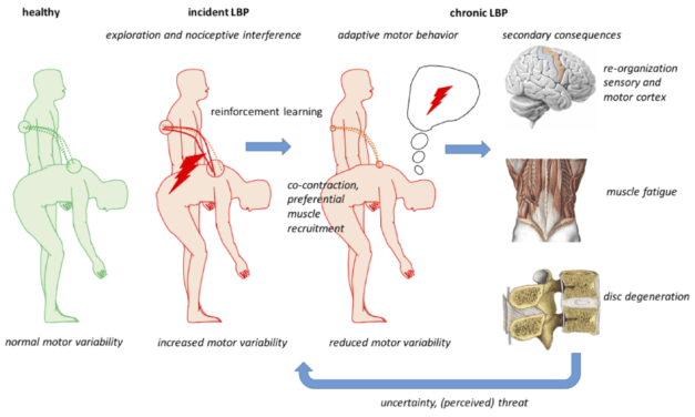 Motor learning in patients with low-back pain