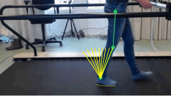 Prosthetic and Orthotic Dynamic Alignment for Rehabilitation
